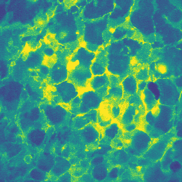 The beauty of voltage imaging in hiPSC-derived cardiomyocytes